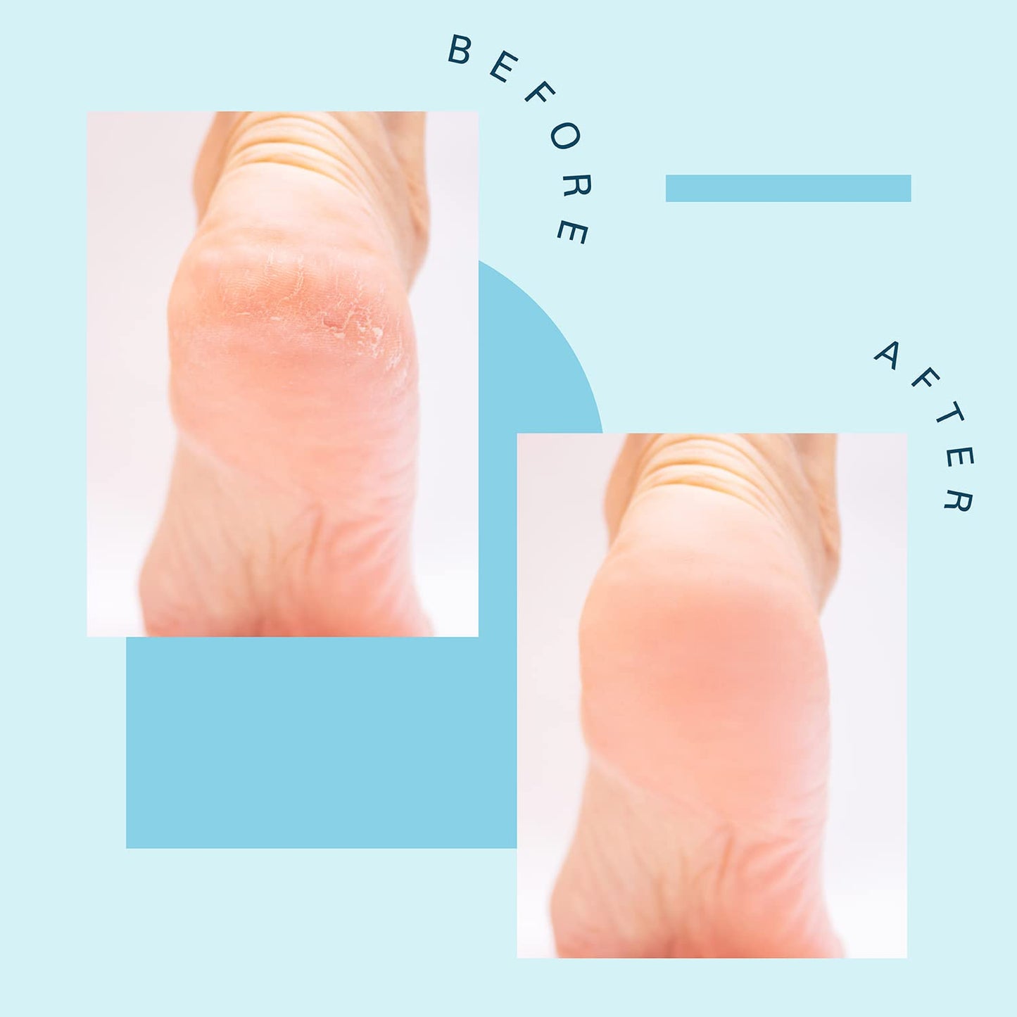 Tea Tree Oil Foot Soak and Epsom Salts for soaking | Foot Spa and Remedy for Athletes Foot, Stinky Feet, and Foot Soak for Dry Cracked Feet | Detox Foot Soak and Tea Tree Oil for Healthy Toenails 16oz