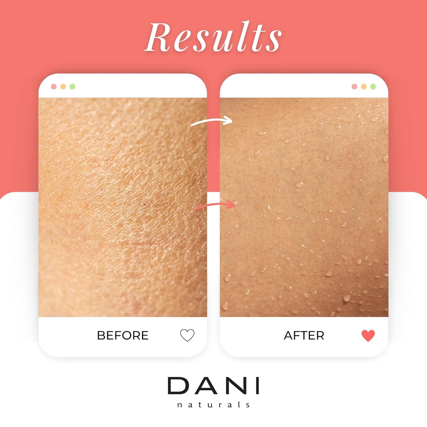 DANI Naturals Exfoliating Sugar Scrub - Coconut Hibiscus, made with organic cane sugar and shea butter, gently exfoliates and deeply hydrates for smooth, radiant skin – 14 oz