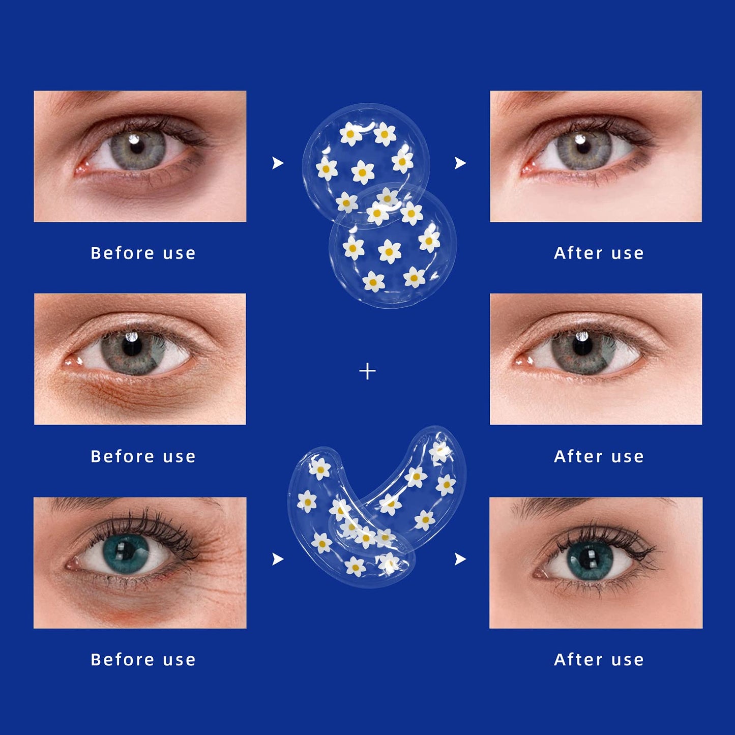 ZNÖCUETÖD Gel Ice Pack Reusable Cooling Eye Pads and Under Eye Patches,Eye Hot Cold Treatment Pack for Redness,Pain Relief and Eye Relax