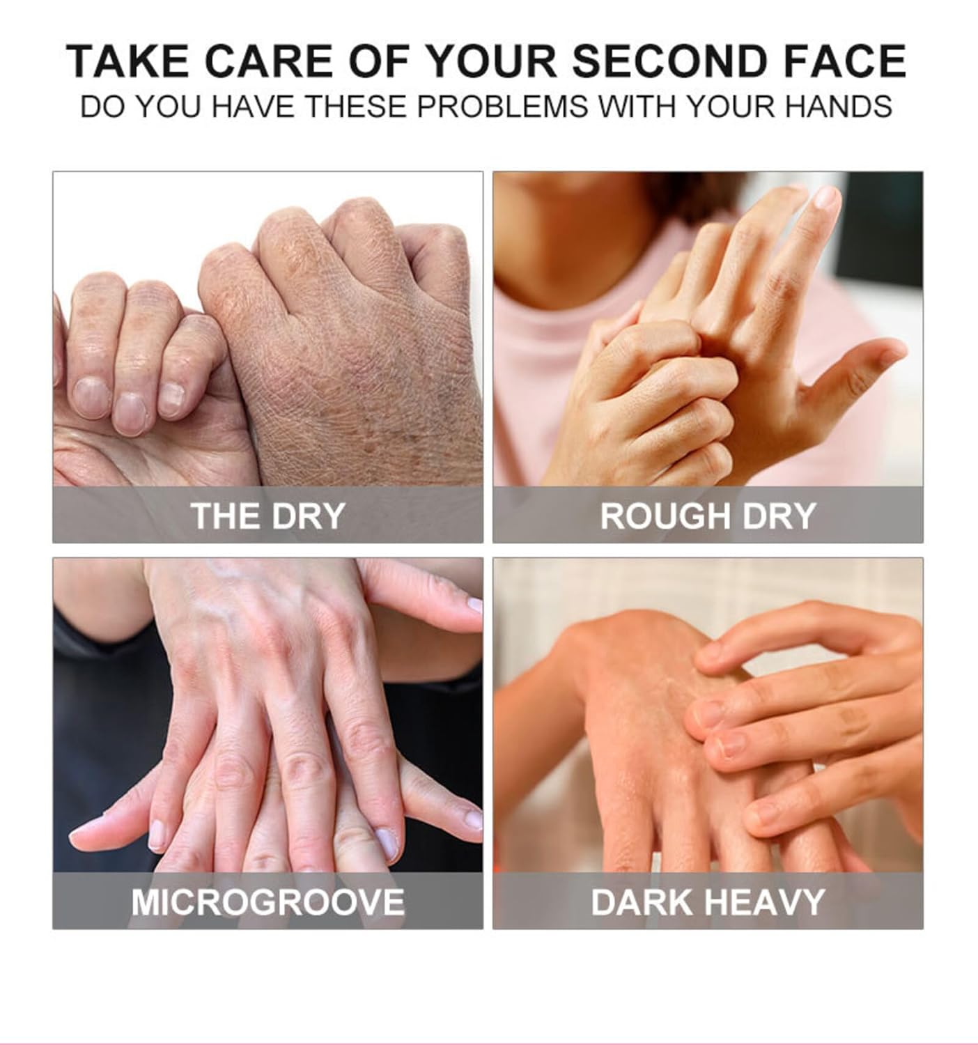 VolksRose Moisturizing Hand Mask Gloves for Dry Cracked Hands, Overnight Repair Treatment - Intensive Hydration Hand Masks with Rose & Milk, 5 Pairs - Spa Care for Extremely Dry, Rough Skin