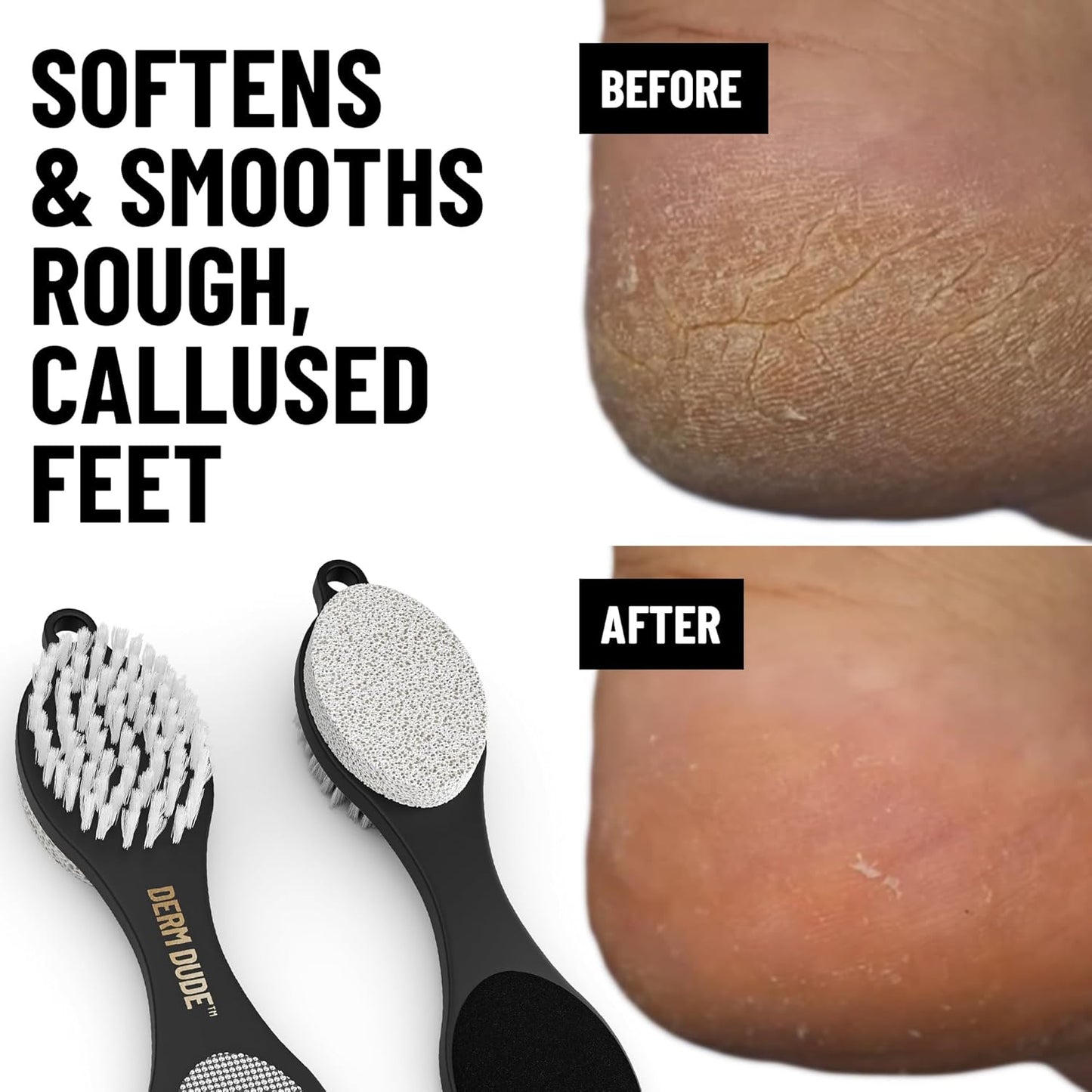 Derm Dude 4-in-1 Foot Scrubber & Heel Repair Tool | Foot File Callus Remover for Feet | Pedicure Tool with Metal File, Pumice Stone, Emery Board & Cleaning Brush to Soften & Smooth Rough, Dry Feet