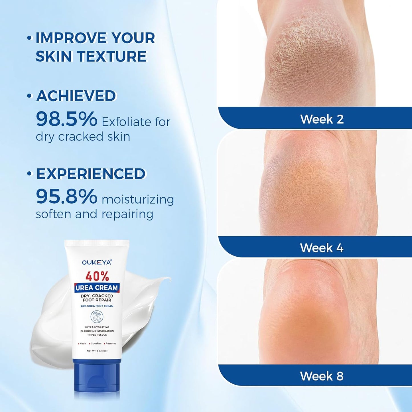 OUKEYA Urea Cream 40 Percent Tube, Urea Cream 40 Percent For Feet Maximum Strength, with Foot Callus Remover, Nano Glass Foot File