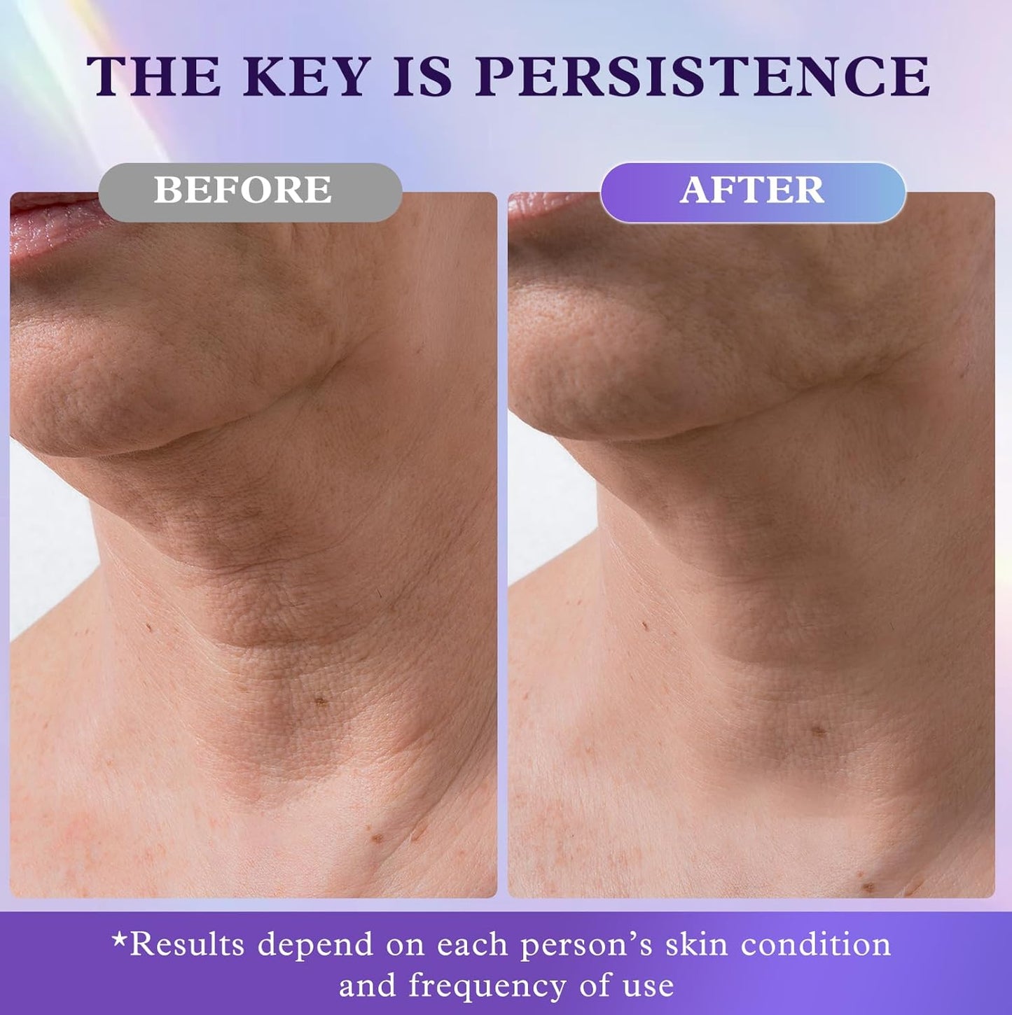 Retinol Neck & Face Wrinkle Cream for Women, Neck Cream for Tightening and Firming, Anti Aging Skin Care with Collagen & Hyaluronic Acid, Instant Face Lift Cream 1.7 Fl Oz