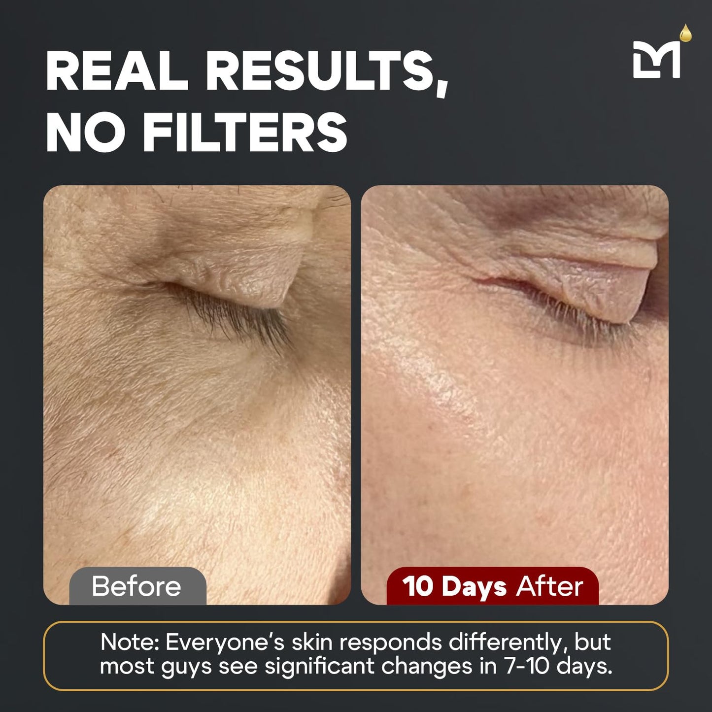 Titan Sports Anti-Aging Mens Skin Care Kit – Cleanser, Face Serum, Eye Cream, Face Moisturizer – Men, Skin Care Set – Dark Circles, Wrinkles, Fine Lines – Vitamin C, Niacinamide, HA–Unscented