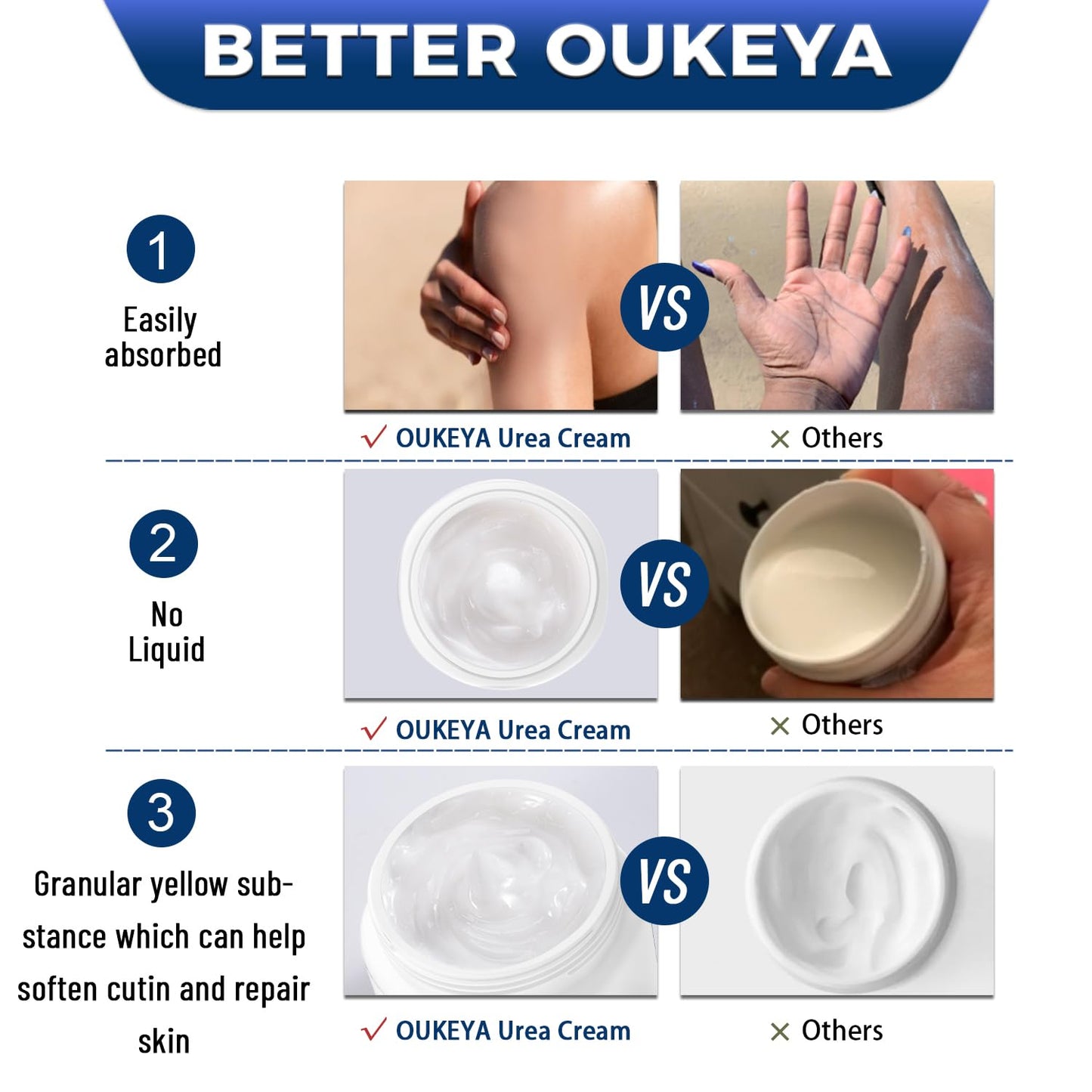 OUKEYA Urea Cream 42% plus Salicylic Acid 2% Net 350g for Dry Cracked Feet, Heels, Knees, Elbows, Hands Repair Treatment.Moisturizes and Removes Corns,Calluses,Dead Skin,and Softens Toenails