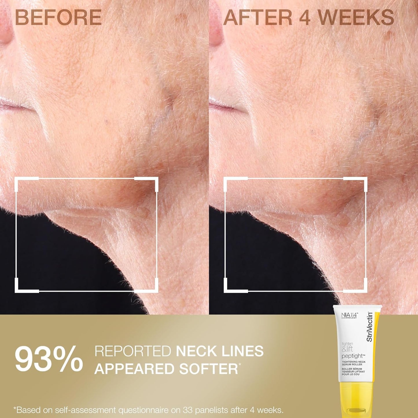 StriVectin Tighten & Smooth Neck Cream and Neck Serum Roller Anti-aging Skin Care 2-Piece Set