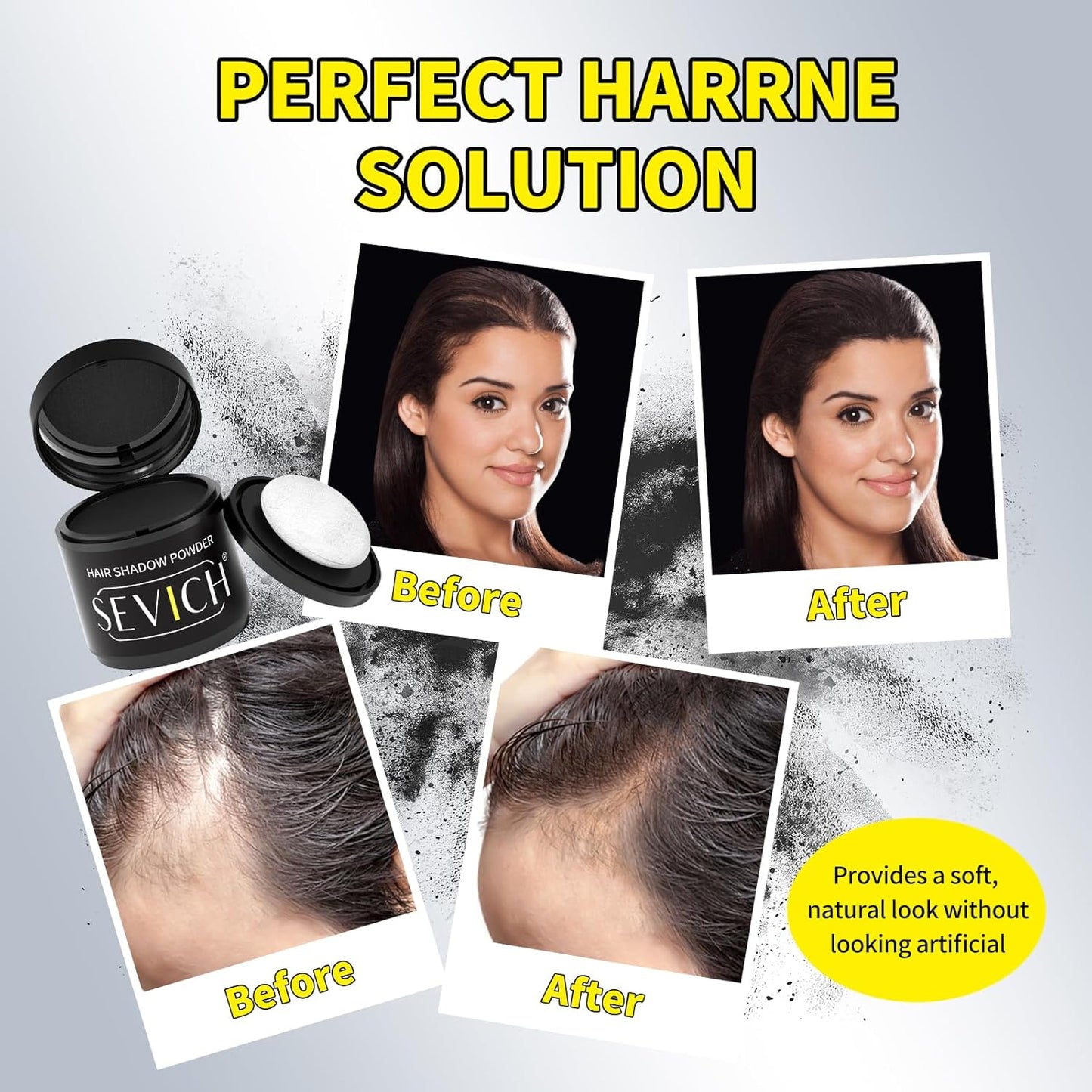 Sevich Hairline Powder 10g with Brush, Instantly Conceals Hair Loss & Thinning & Gray, 48H Waterproof Root Touch Up Powder, Natural Hair Shadow Toppers for Women & Men, 1 Box = 2.5 Boxes,Med Brown