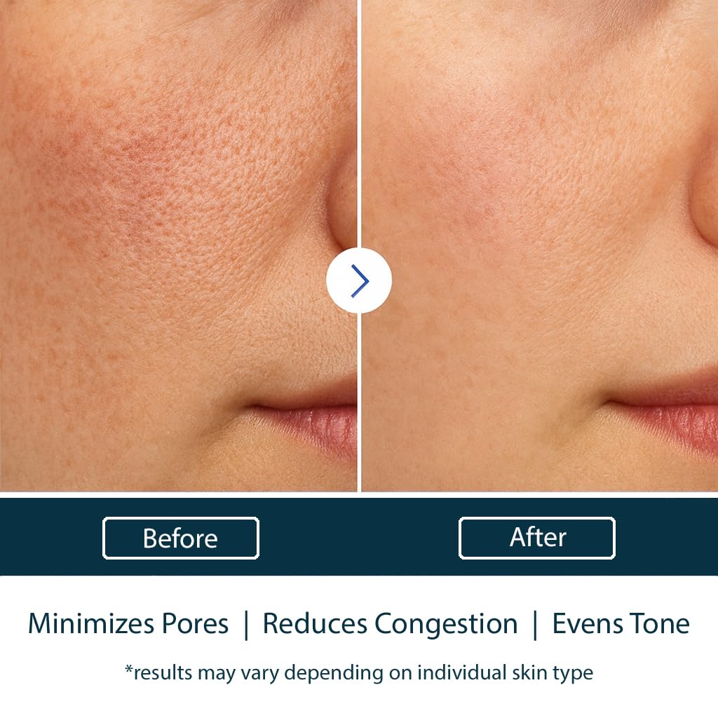 NAELI AHA/BHA Exfoliating Face Wash - 10% Glycolic Acid & Salicylic Acid Cleanser, Anti Aging Acne & Wrinkle Reducing Facial Exfoliant, Pore Minimizer & Brightening Gel, 6 oz