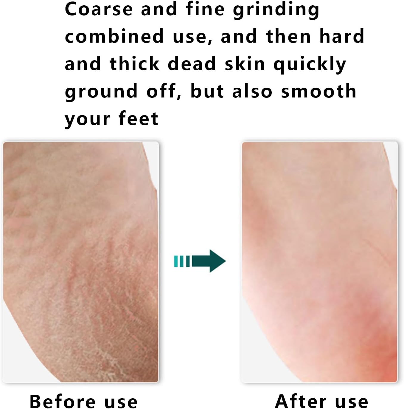 Foot rasp Foot File and Callus Remover. Best Foot Care Pedicure Surface Tool to Remove Hard Skin. Can be Used on Both Wet and Dry feet,Wood Foot File