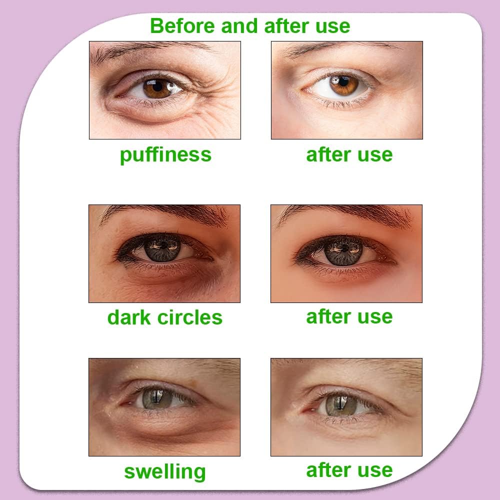 Hot and Cold Eye Pads, reusable eye patches - Soothing, Revitalizing, Puffiness, Refresh, Relieves Stress, Relax, Relieves Puffiness and Tension(2 watermelons + 2 cucumbers)