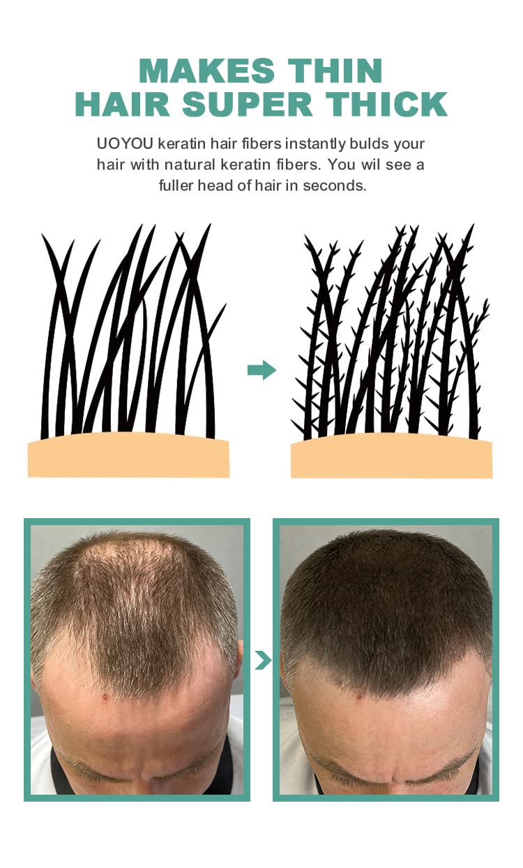 MEDIUM BROWN Hair Fibers for Thinning Hair 27.5g Bottle | Undetectable & Natural Keratin Hair Fibers Concealer for Hair Loss for Men and Women | Hair Building Fibres Powder [MEDIUM BROWN]