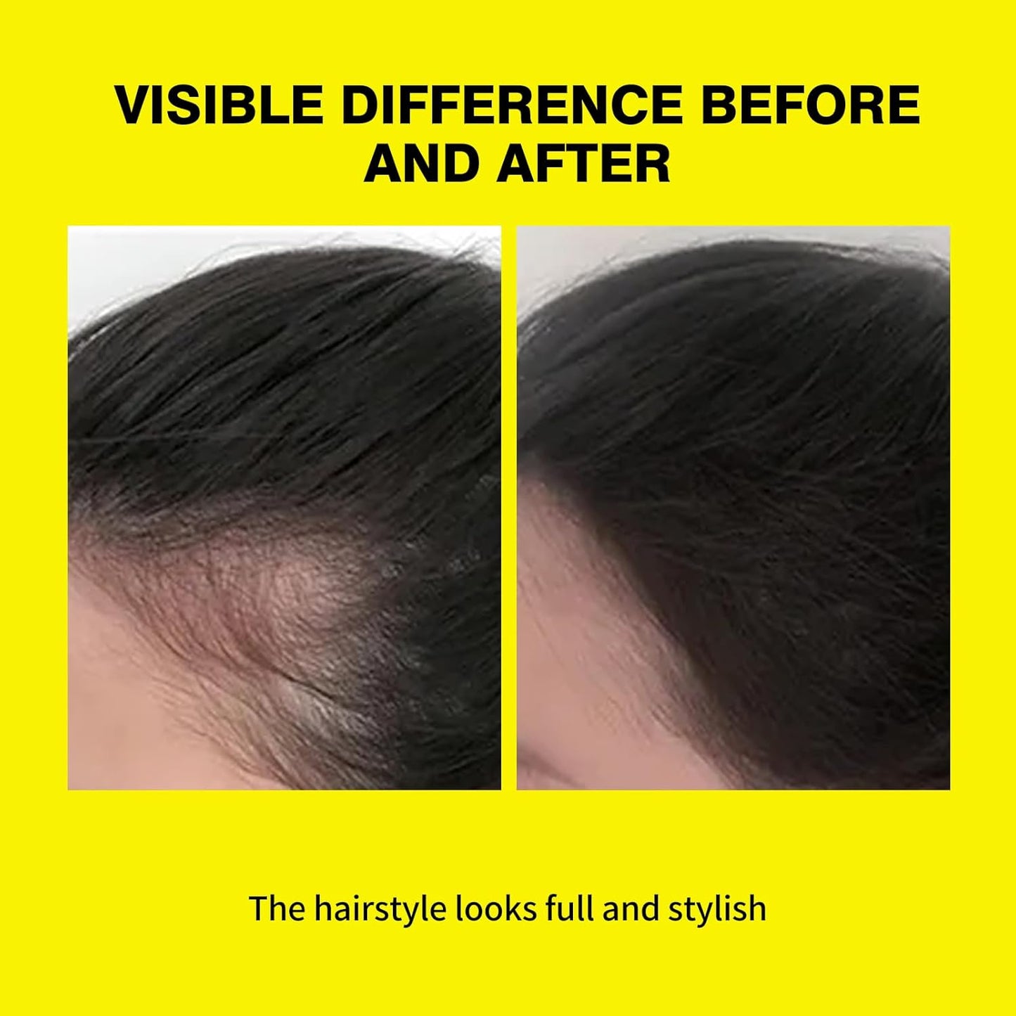 SEVICH 2-in-1 Hairline Powder & Volumizing Powder for Gray Coverage & Fluffy Roots – Oil-Absorbing, Natural-Looking, Travel-Friendly with Mirror – Black