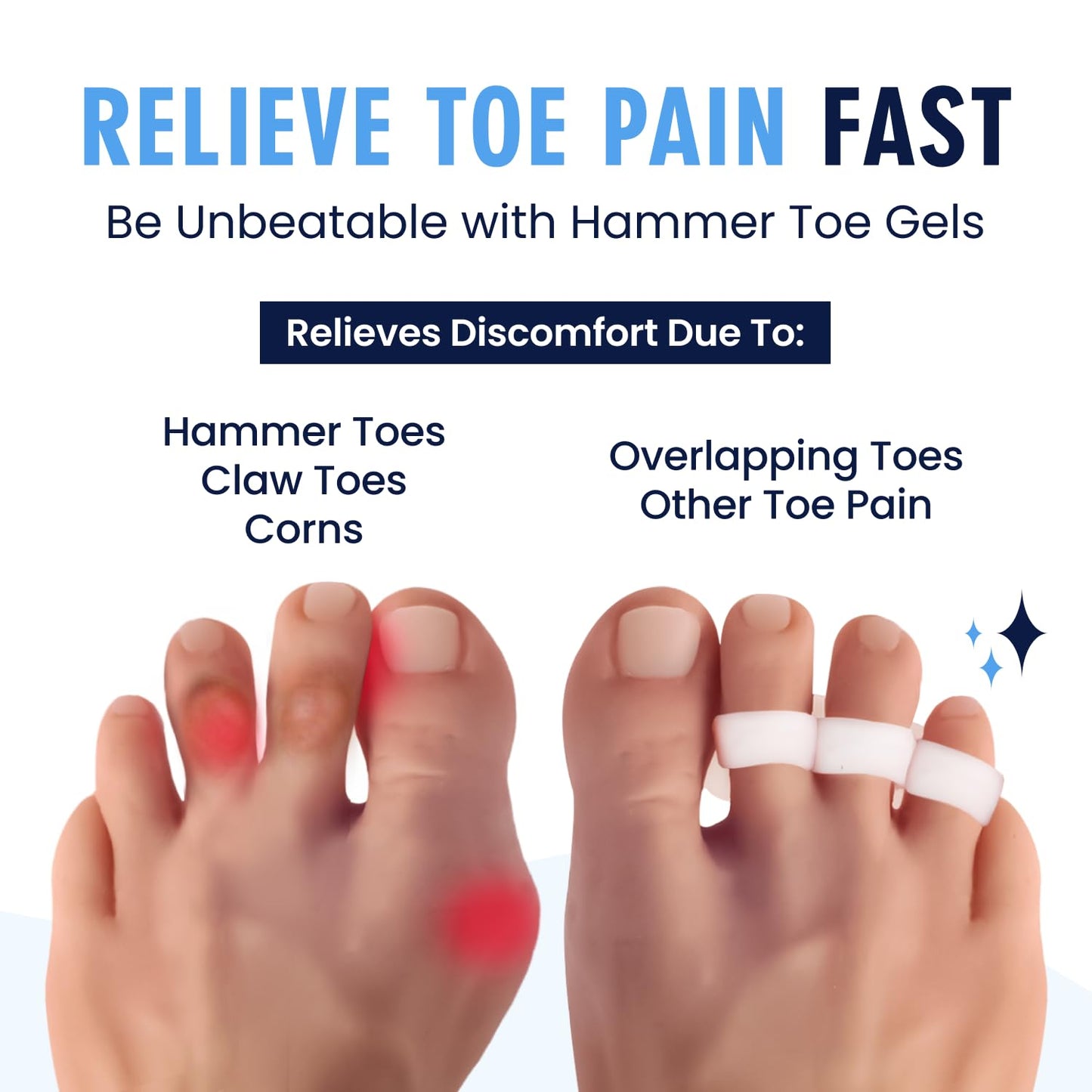 Dr. Frederick's Original Hammer Toe Gels - 2 Pairs - All-Day Relief for Crooked & Overlapping Toes - Soft Cushioning - Symptomatic Support for Toe Alignment - White - 3 Loop Design
