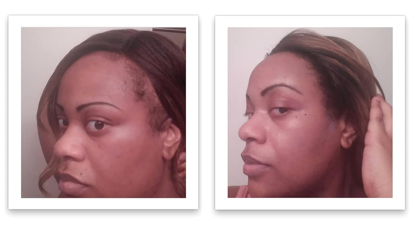 Caboki Hair Building Fiber + Built-in Spray Applicator (30-50 Days Supply). Black