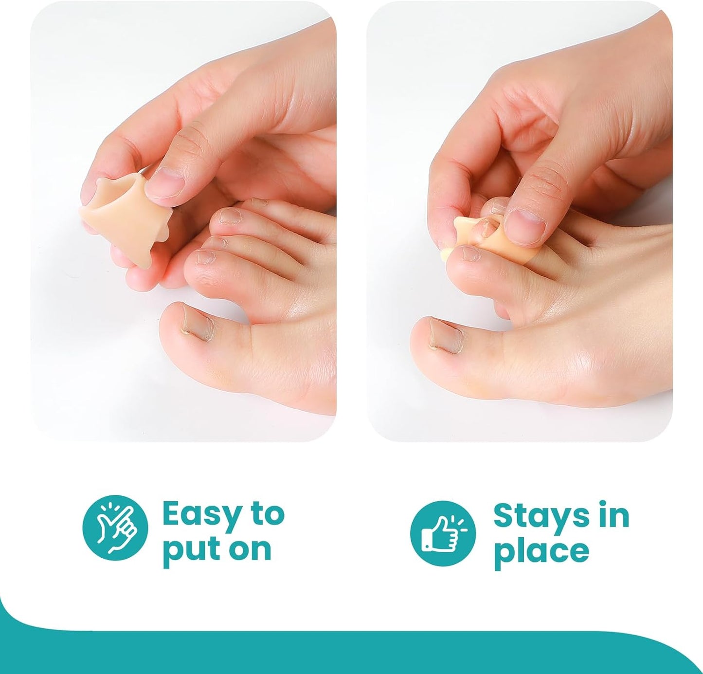 Hammertoe Corrector for Women - Soft Gel Toe Straighteners - Realign Bent, Curled, Crooked, Claw, Bunion, Hammer Toes - Toe Corrector for Men（6 Count, Medium, Beige）