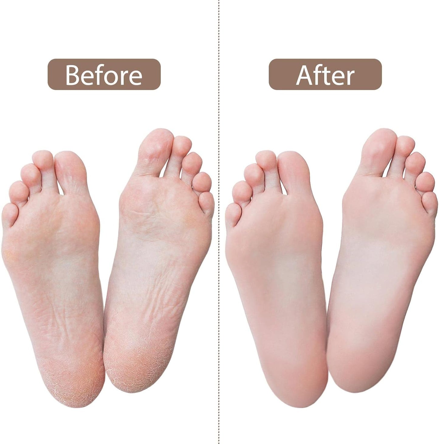 Tbestmax 12 Pcs Silicone Gel Socks for Dry Cracked Feet Heels Women - Day & Night Socks - W4-10 | M5-8