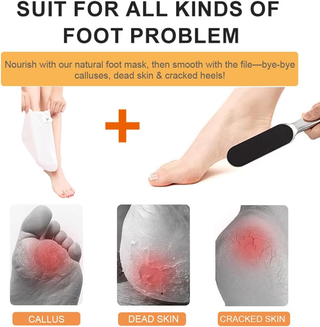 Professional Stainless Steel Foot File & Rasp Callus Remover - Remove Hard & Dead Skin, Dual Sided for Wet and Dry Feet, Innovative Pedicure Solution with 2pcs Foot Mask Set