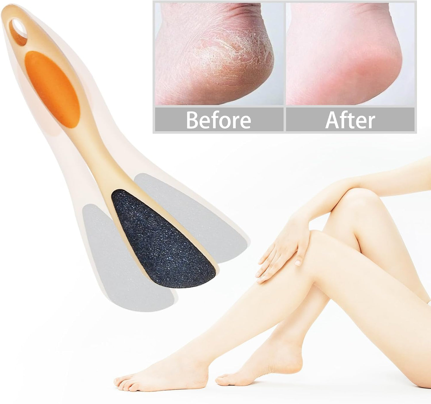 Double Sided Foot File Callus Remover 2-Pack, Pumice Stone for Feet with Ergonomic Handle, Dead Skin Remover for Cracked Heels, Pedicure Tool for Dry or Wet Use at Home & Salon