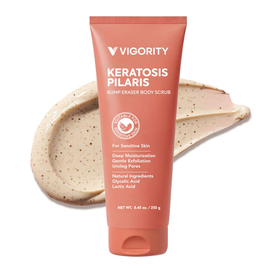 Vigority KP Bump Eraser Body Scrub: Keratosis Pilaris Treatment for Strawberry Legs - Exfoliates & Deeply Hydrates for Smoother Healthy-Looking Skin