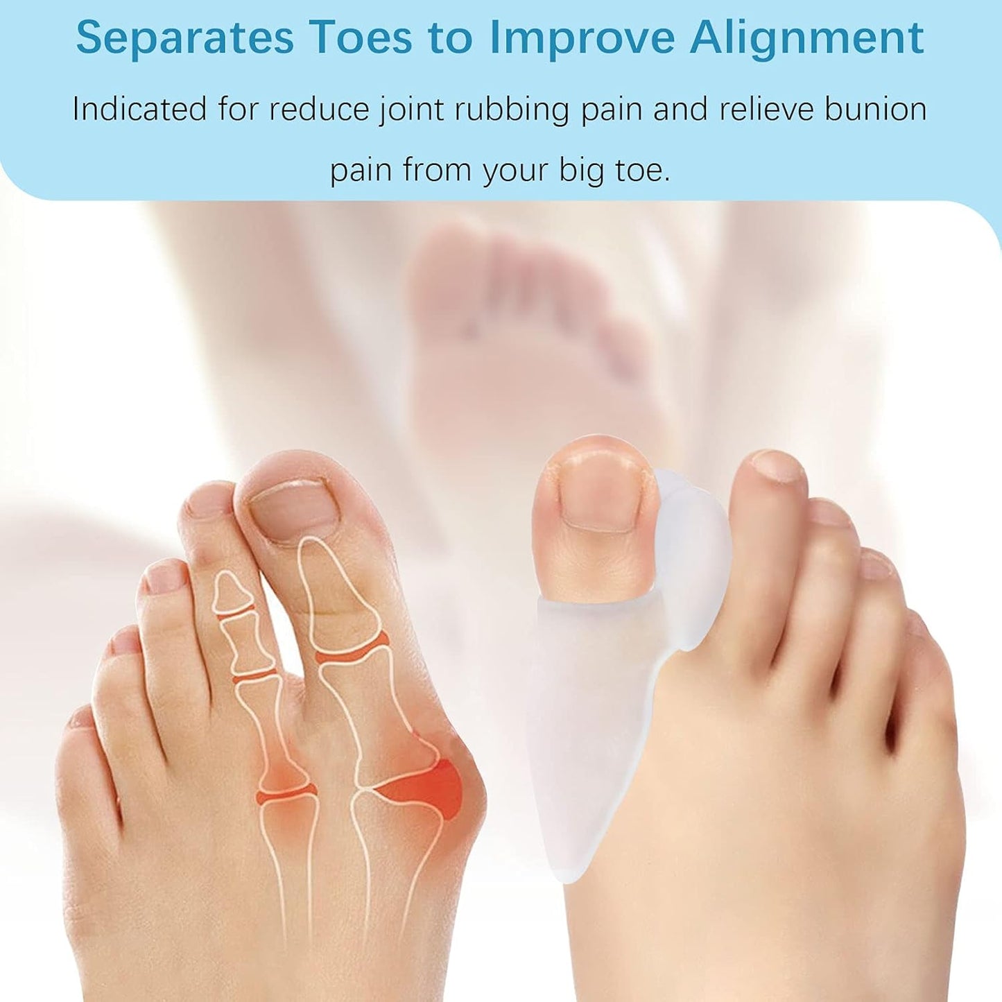 Pack of 12 Bunion Cushions and Protectors, (1/2'' Thick) Bunion Pad with Gel Shield, Bunion Corrector with Separator for Big Toe, Bunion Shield for Pain Relief from Bunion Pain, Pressure