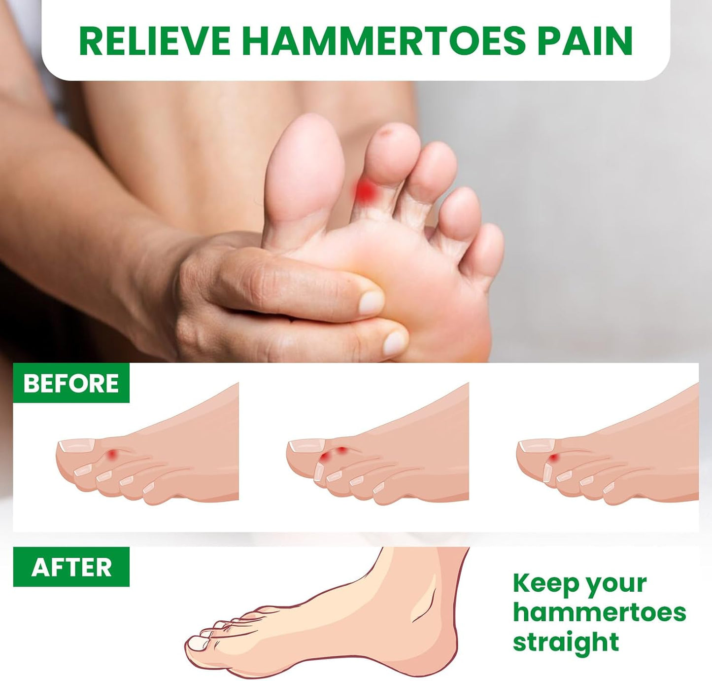 Bukihome Hammertoe Corrector - 6 Pack Toe Splints - Soft Gel Toe Straighteners - Realign Bent, Curled, Crooked, Claw, Hammer Toes - Toe Corrector for Men and Women, Large Sizes (White)