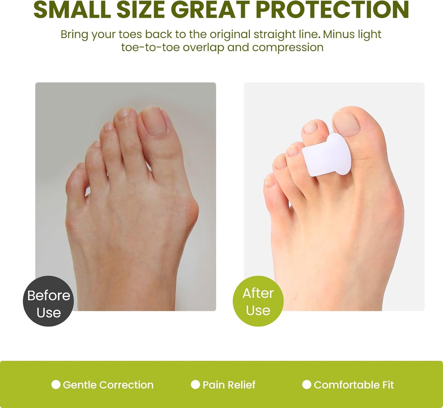 Bukihome Gel Toe Separators for Women -10 Pack Toe Spacers for Overlapping Toes, Bunions, Big Toe Alignment, Bunion Relief - Soft Silicone Toe Corrector for Men (Medium Size)