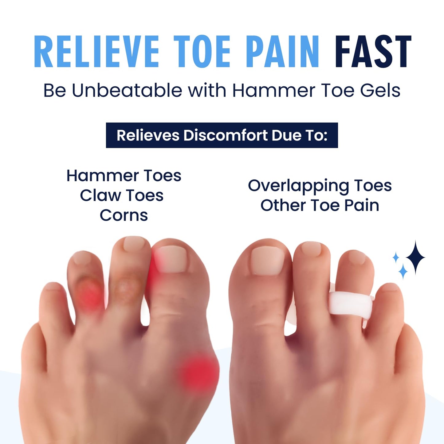 Dr. Frederick's Original Hammer Toe Gels - 2 Pairs - Hammertoe Support Crest for Women & Men - Cushion & Temporary Splint for Toe Alignment, Crooked Toes, and Pain Relief - White - 1 Loop Design