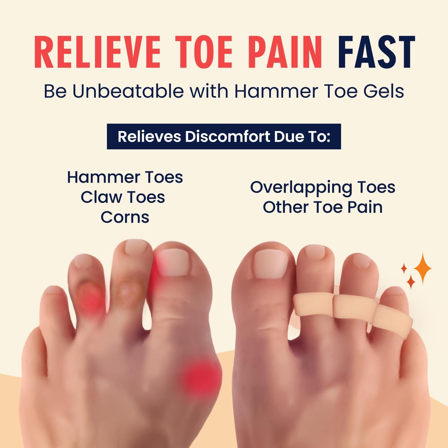 Dr. Frederick's Original Hammer Toe Gels - 2 Pairs - All-Day Relief for Crooked & Overlapping Toes - Soft Cushioning - Symptomatic Support for Toe Alignment - Beige - 3 Loop Design