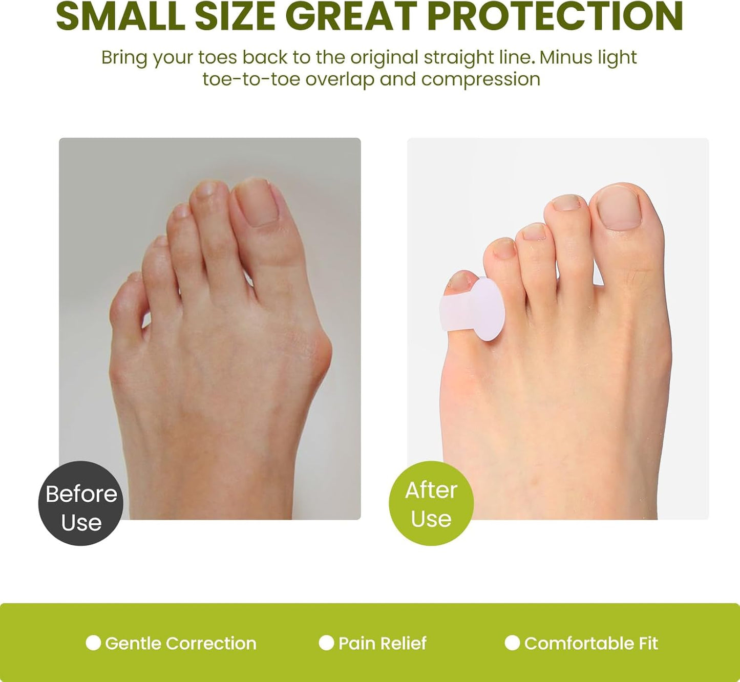 Bukihome Gel Pinky Toe Separators for Women -10 Pack Toe Spacers for Overlapping Toes, Bunions, Toe Alignment, Bunion Relief - Soft Silicone Toe Corrector for Men (Pinky Size)