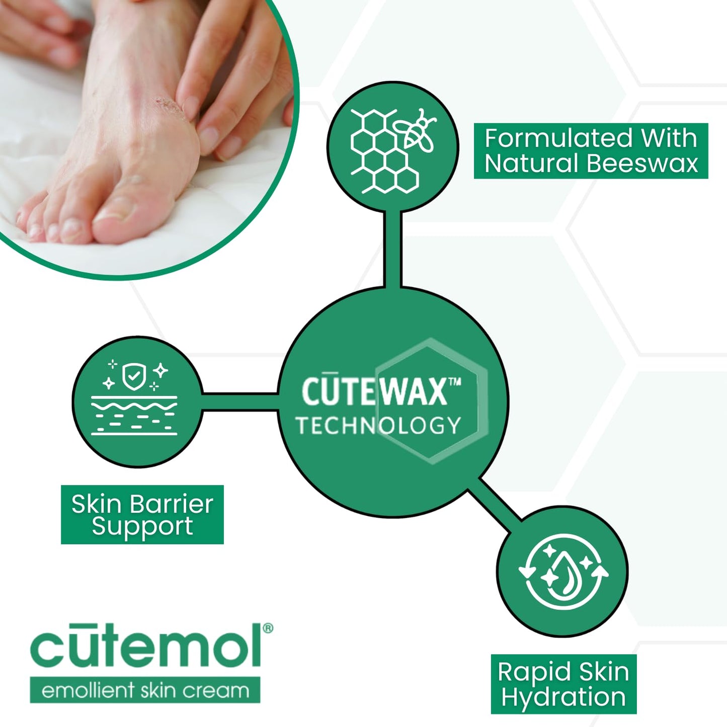 Cutemol Emollient Moisturizing Cream - Serious Moisturizer Lotion Balm for Recovering Dry, Damaged Skin - Hydration for Cracked Hands and Feet, Eczema, Psoriasis, and Raw Skin (8 oz)