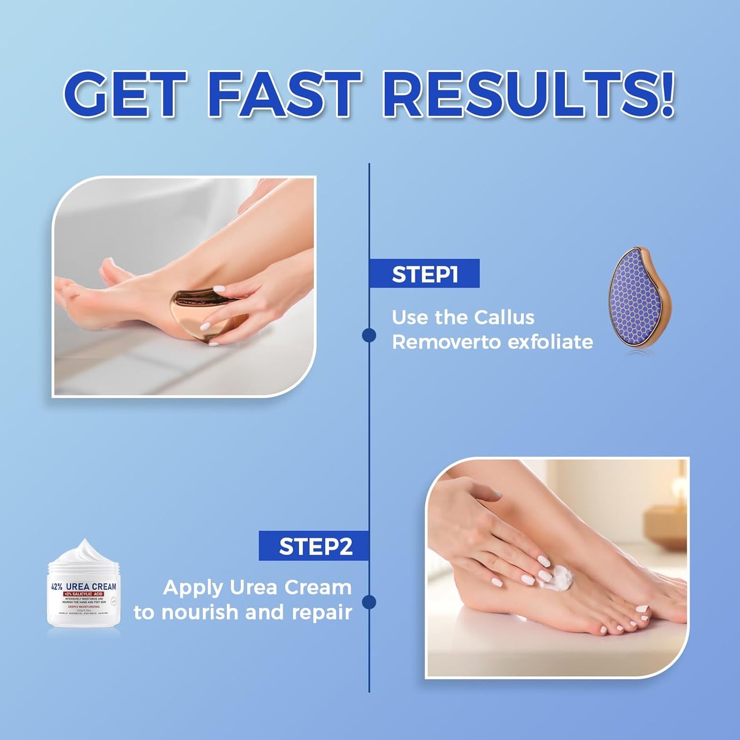 OUKEYA Urea Cream 42 Percent for Foot & Hand Cream with Foot Files for Dry Cracked Urea Lotion for Feet Maximum Strength Foot Cream for Dry Cracked Treatment