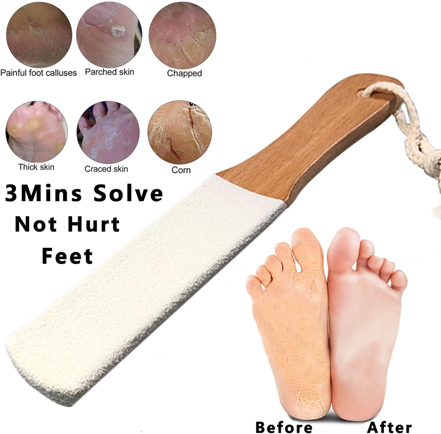 Feet Callus Removers Professional Colossal Foot Scrubber Pedicure Foot File Foot Massager Pumice Stone for Feet,Remover Corn Hard Skin Dead Skin Exfoliator for Use in Shower Feet Care Tools