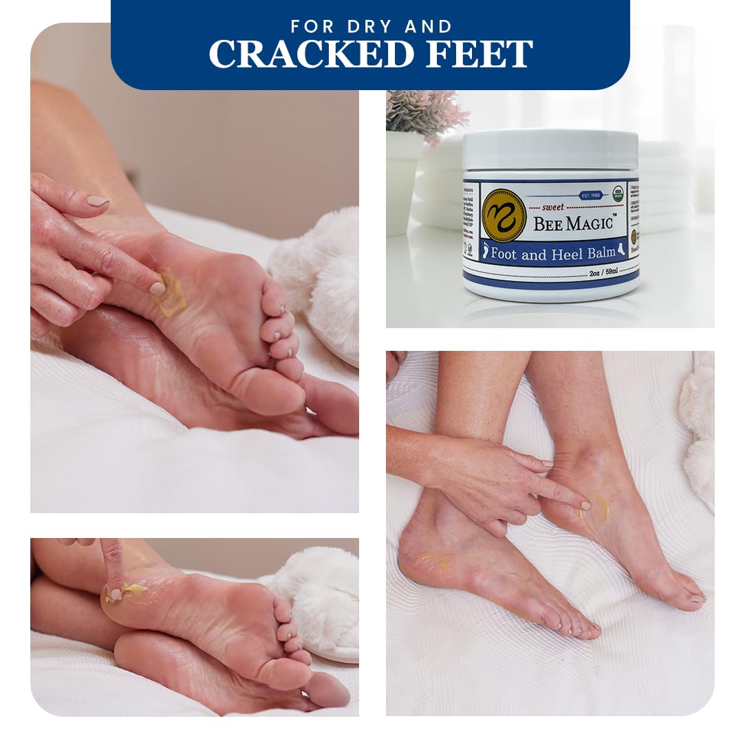 Sweet Bee Naturals Organic All Natural Foot and Heel Balm 2 (2 OZ Jars). For Dry and Cracked Feet Repair. Organic Salve Moisturizer for Heel Care & Callus Treatment. Made in USA. 2 Jars (4 OZ)
