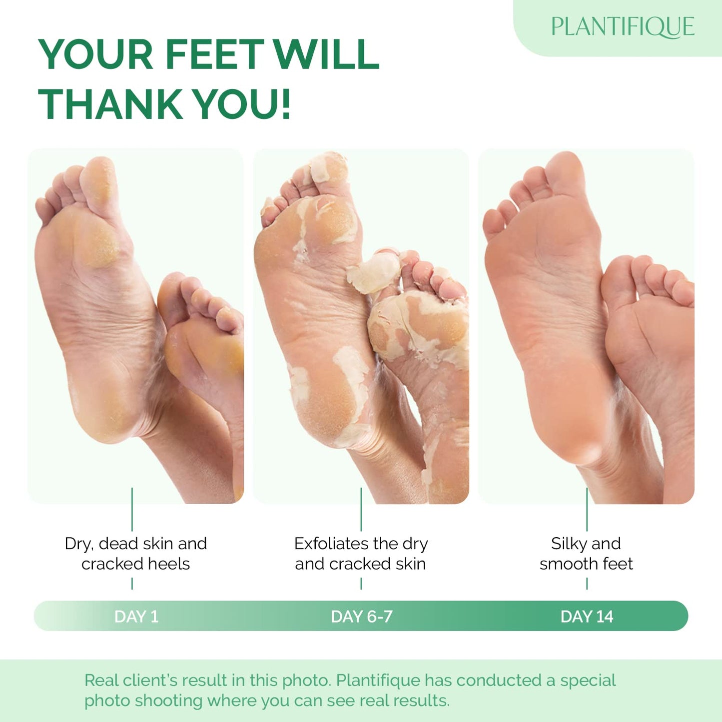 PLANTIFIQUE Foot Peeling Mask 1 Pack | Dermatologically Tested Repairs Heels & Removes Dry Dead Skin for Baby Soft Feet | Exfoliating Foot Peel Mask for Dry Cracked Feet | Peach