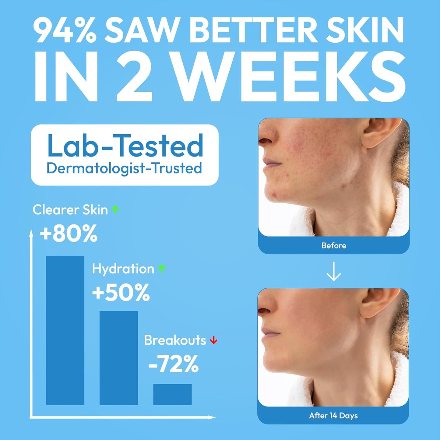 FOMIN Cleansing Facial Towel 50 Count - Disposable Face Towelette XL - Biodegradable, Ultra-soft, Plant Based & Tear-Resistant Face Cloths - Towels for Makeup Remover & Reduce Acne for Clearer Skin