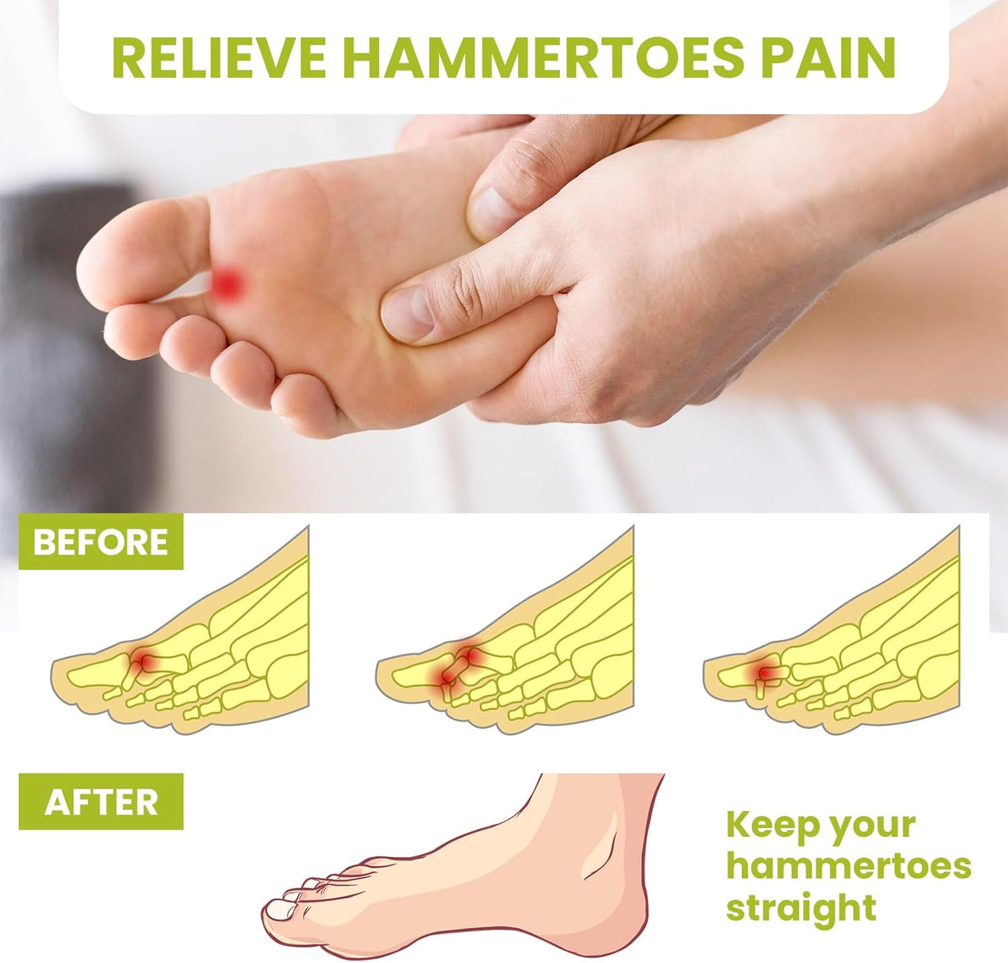 Bukihome Hammertoe Corrector Gel Toe Straighteners - 12 pcs Support Crest for Women & Men - Realign Bent, Crooked, Curled, Claw, Hammer Toes - Clear,Single Loop