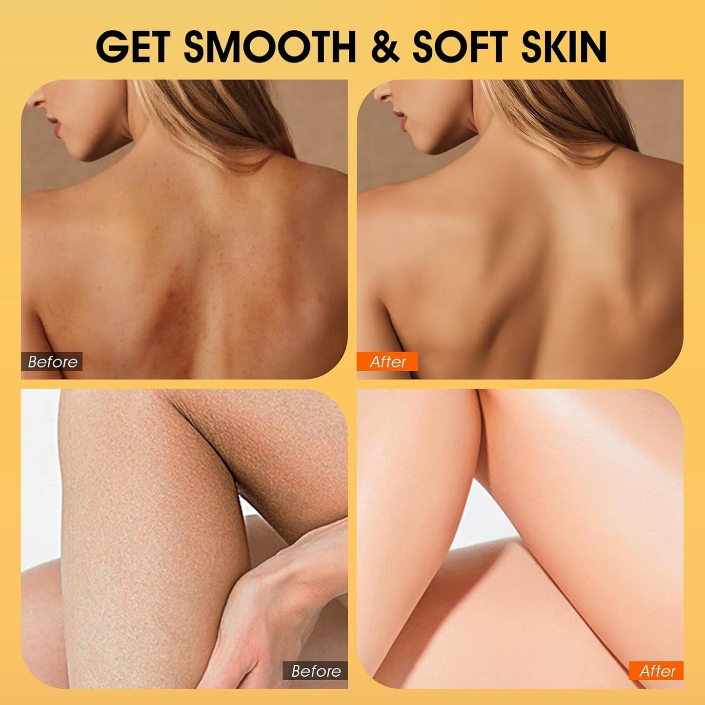 Body Scrub, Turmeric Exfoliating Body Scrub, with Coconut Oil & Vitamin C, Bikini Area Exfoliator Gently Exfoliate Body Hand and Foot Scrub, Moisturized Skin for Women and Men, 11.28oz/320g