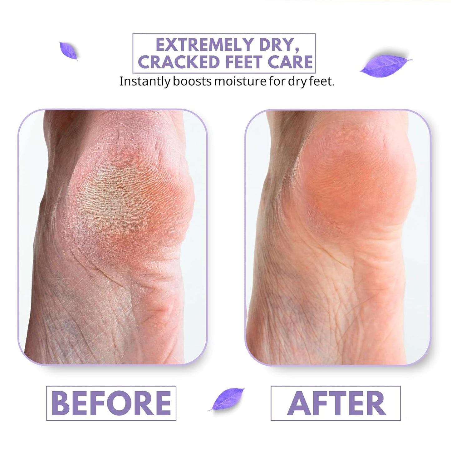 Foot Cream for Long-Lasting Odor Control (Neutralizes Odor at the Source) (Hydrates Dry, Cracked Feet) with Natural Mushroom Extract