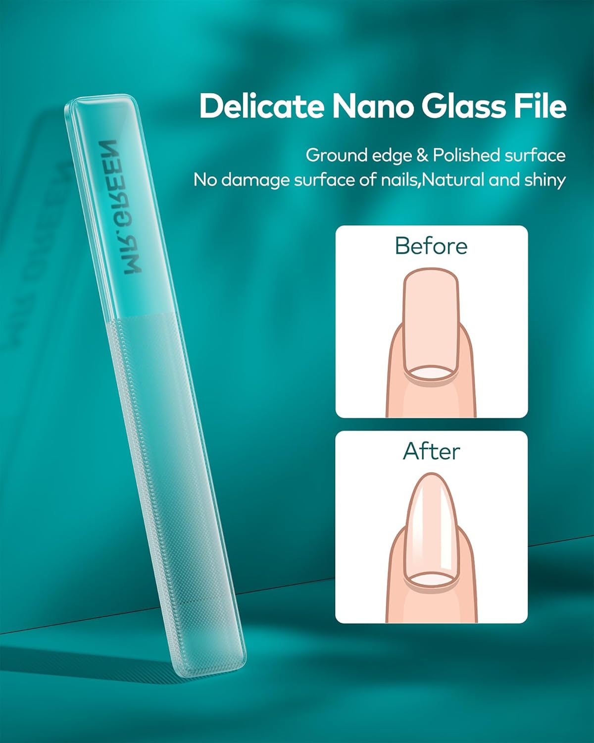 MR.GREEN Nail Clippers, Upgraded Anti-Splash Nail Clipper Set with Nail File and Tweezers & Catcher, Professional Practical Manicure Nail Care Kit with Exquisite Leather Case for Men & Women