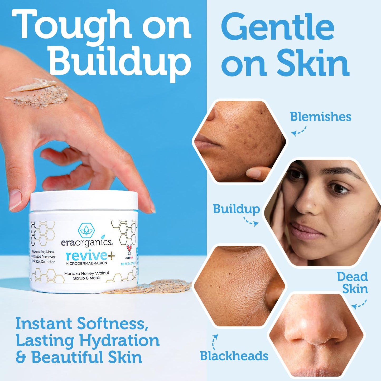 Era Organics Microdermabrasion Facial Scrub & Face Exfoliator - Spa Quality Exfoliating Mask with Manuka Honey Plus Walnut for Blackheads, Buildup, Wrinkles 2oz