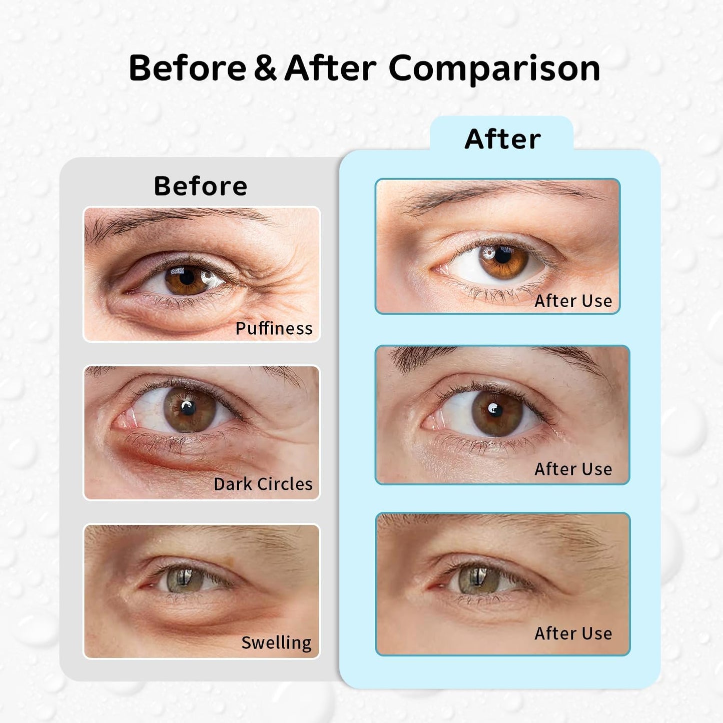 Gel Ice Pack Reusable, Cooling Eye Pads and Patches, Hot and Cold Eye Pads - Soothing, Revitalizing, Puffiness, Refresh, Relieves Stress, Relax, Relieves Puffiness and Tension(2 Crabs+2 Pandas)