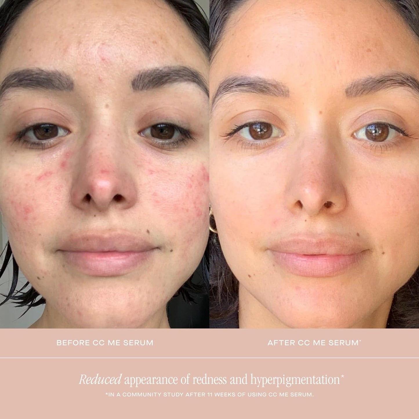 Summer Fridays CC Me Serum with Vitamin C + Niacinamide - Brightening + Hydrating Face Serum to Improve Skin Tone + Reduce Appearance of Dark Spots Over Time (1 Fl Oz)