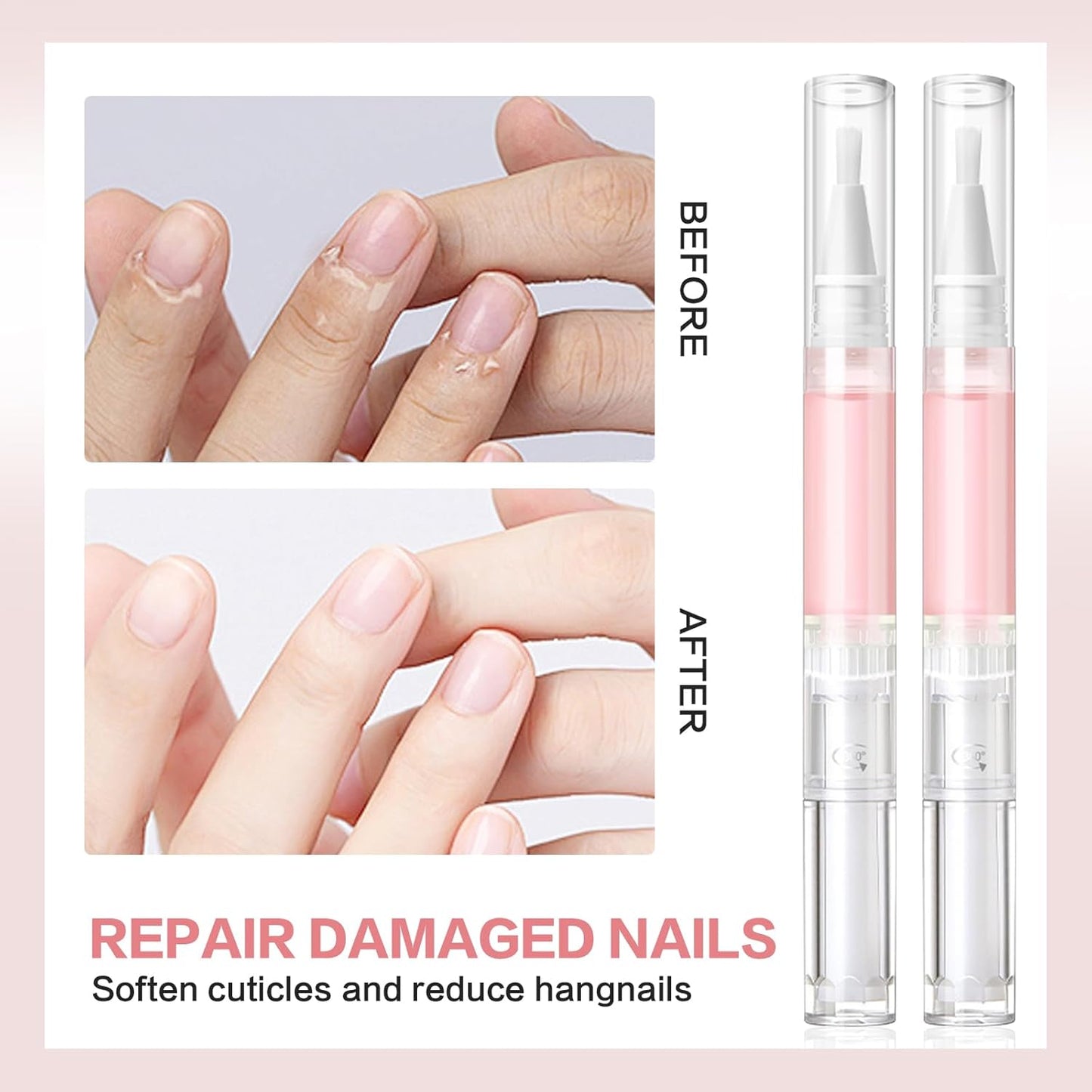 Radiant Nail Growth Oil, Nail Strengthener, Cuticle Oil for Nails, Moisturize Strengthen Nail Care Oil, Finger Edge Manicure Nourishing Pen, Anti-hangbnail removal, Nail Skin Edge Care (Rose)