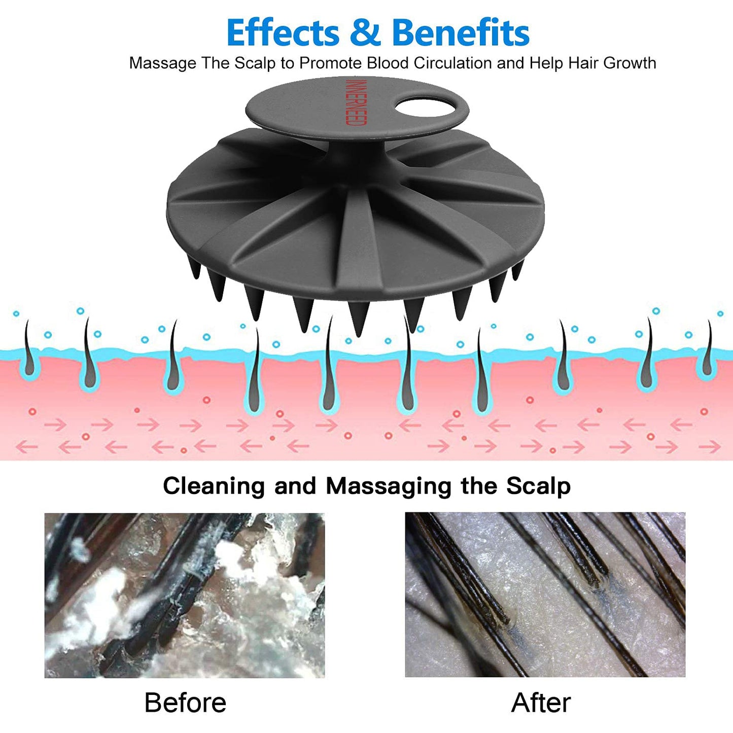 INNERNEED Scalp Massager Shampoo Brush, Wet & Dry Manual Scalp Care Head Scrubber Hair Washing, Soft Silicone Bristles, for Hair Growth, Dandruff Removal (Black+Gray)