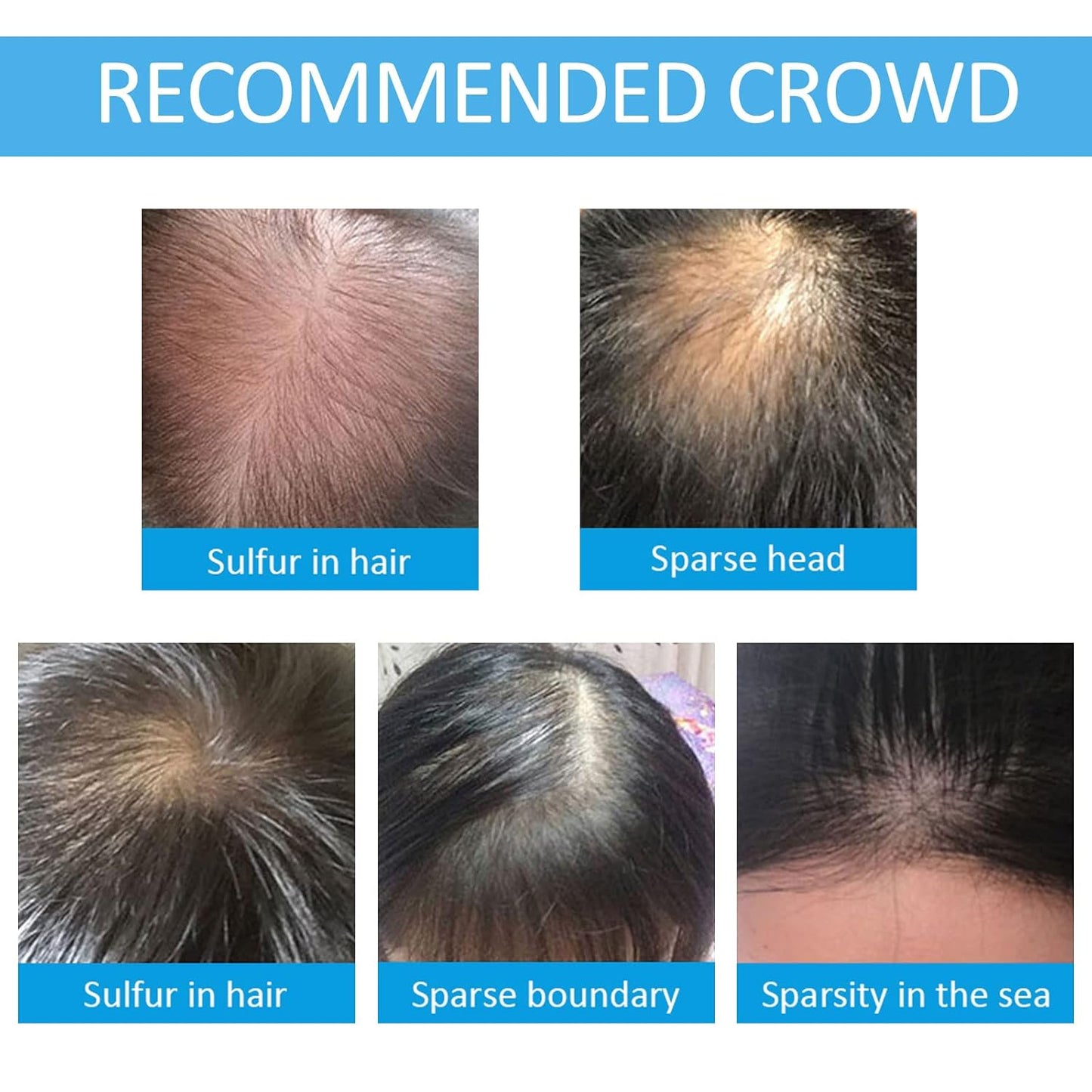 Hair Building Fibers for Thinning Hair with Spray Applicator Pump Nozzle, Natural Keratin & Undetectable, Instantly Fuller, Thicker Look, Conceals Hair Loss in Seconds, Hair Powder for Women & Men