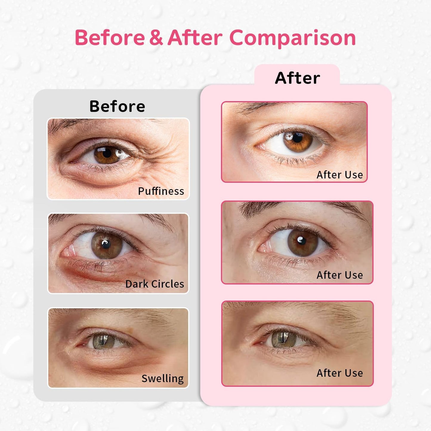 4PCS Gel Eye Ice Pack Set, Cold & Hot Compress, Reusable Cooling Gel Pads for Strain Relief, Relaxation, SPA and Sleep (4 Strawberries)