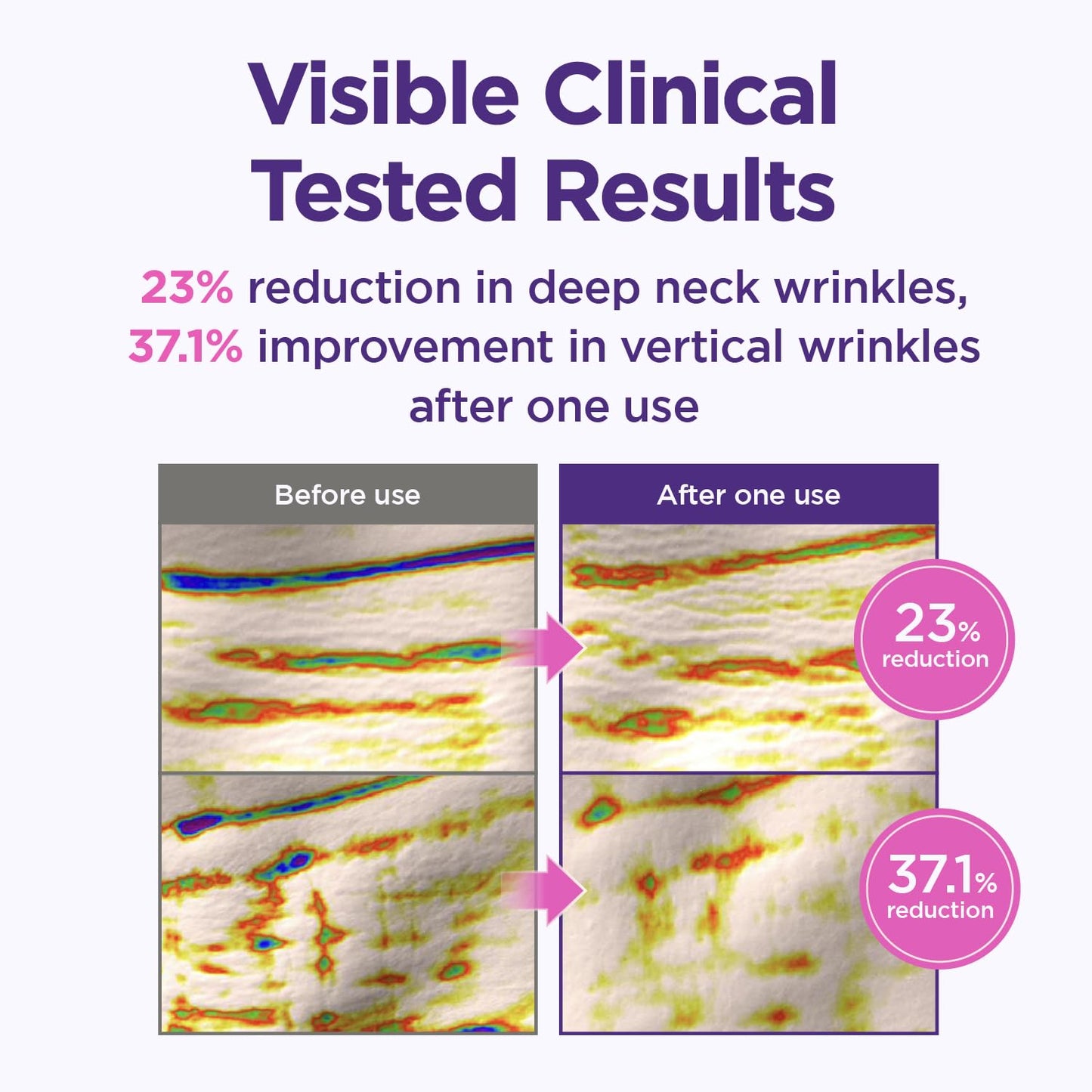 CKD Gua Sha Neck Cream Filltocshot - Advanced Anti-Aging Neck Firming Cream with Massage Roller. Visibly Reduces Wrinkles, Lifts & Tightens Sagging Skin, Boosts Elasticity, Korean Skincare, 1.69 fl oz