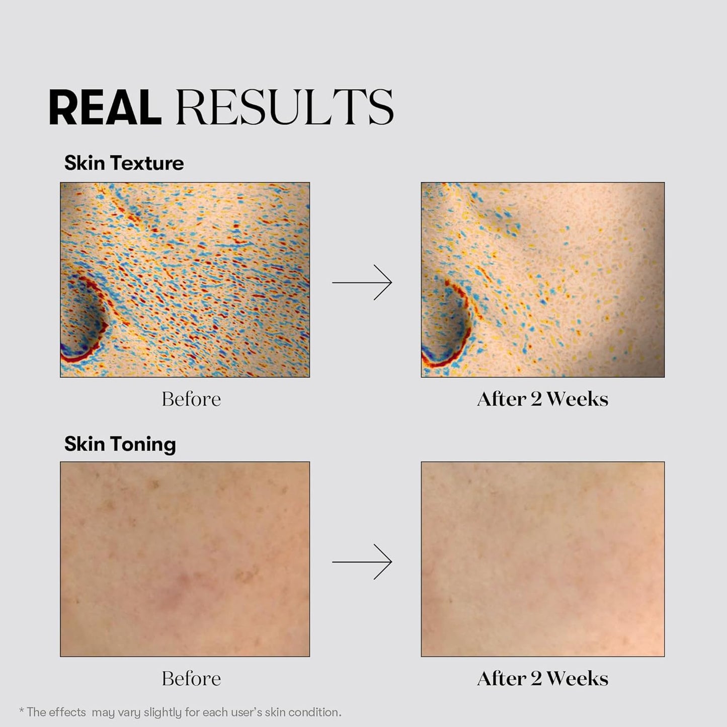 VT COSMETICS TX Toning Daily Mask 30 Sheets, Tranexamic Acid, Niacinamide, Glutathione for Acne Scars, Dark Spots, Sun Spots, Hydrating & Glowing Facial Mask, Fragrance-Free, Korean Face Mask