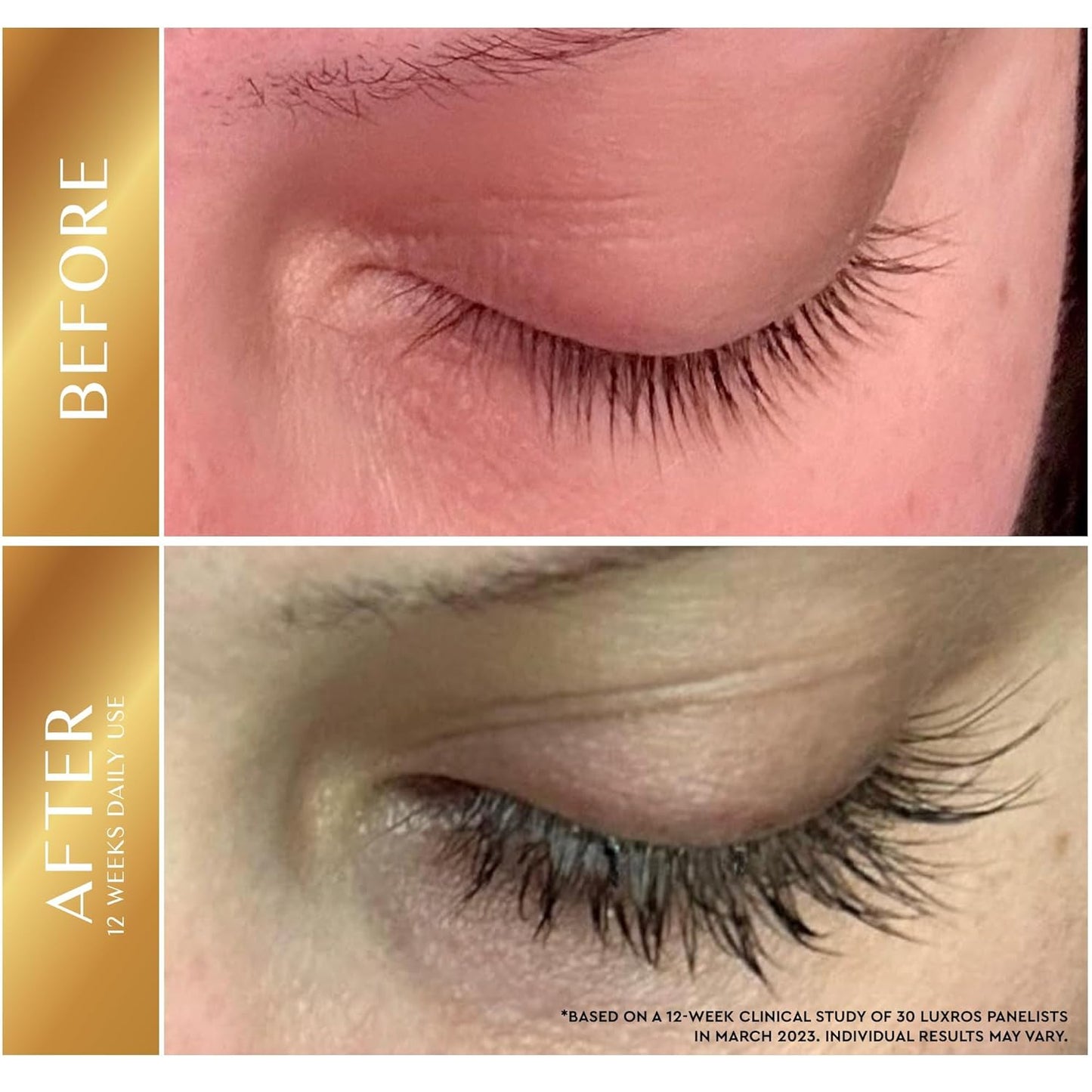 Eyelash Growth Serum 5 mL: Get Thick, Strong Lashes in Just 3-4 Weeks with Our Plant-Based Eyelash Growth Serum - No Parabens - Made in USA