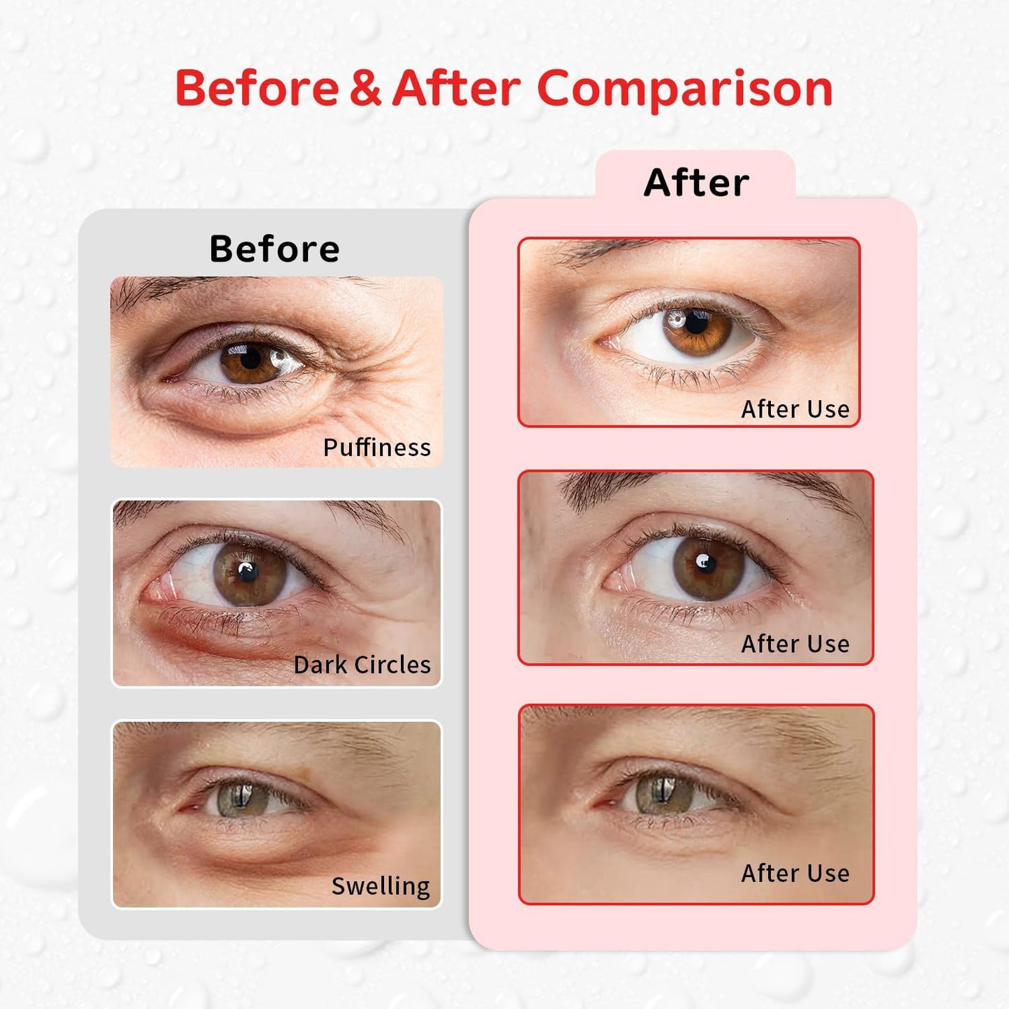 4PCS Gel Eye Ice Pack Set, Cold & Hot Compress, Reusable Cooling Gel Pads for Strain Relief, Relaxation, SPA and Sleep (4 Apples)